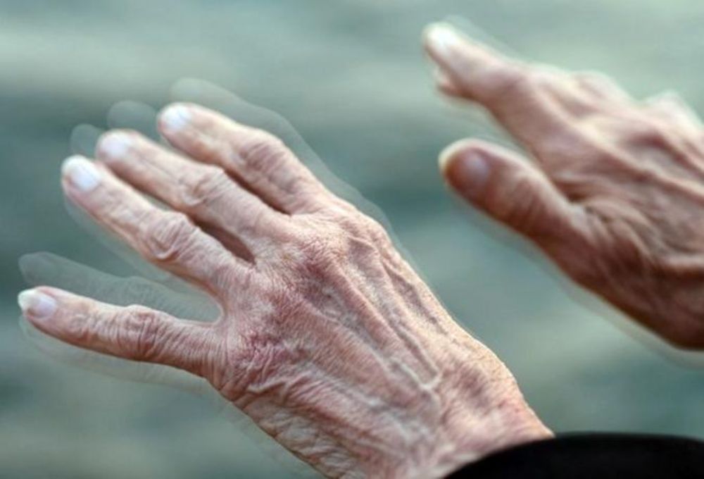 Quais os direitos previdenci�rios para quem sofre de Mal de Parkinson?
